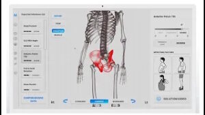 Moti Physio – Analyse Posturale 3D de Précision pour Professionnels de Santé
